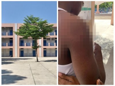 Insécurité : Une balle perdue blesse un élève de Saint Louis de Gonzague